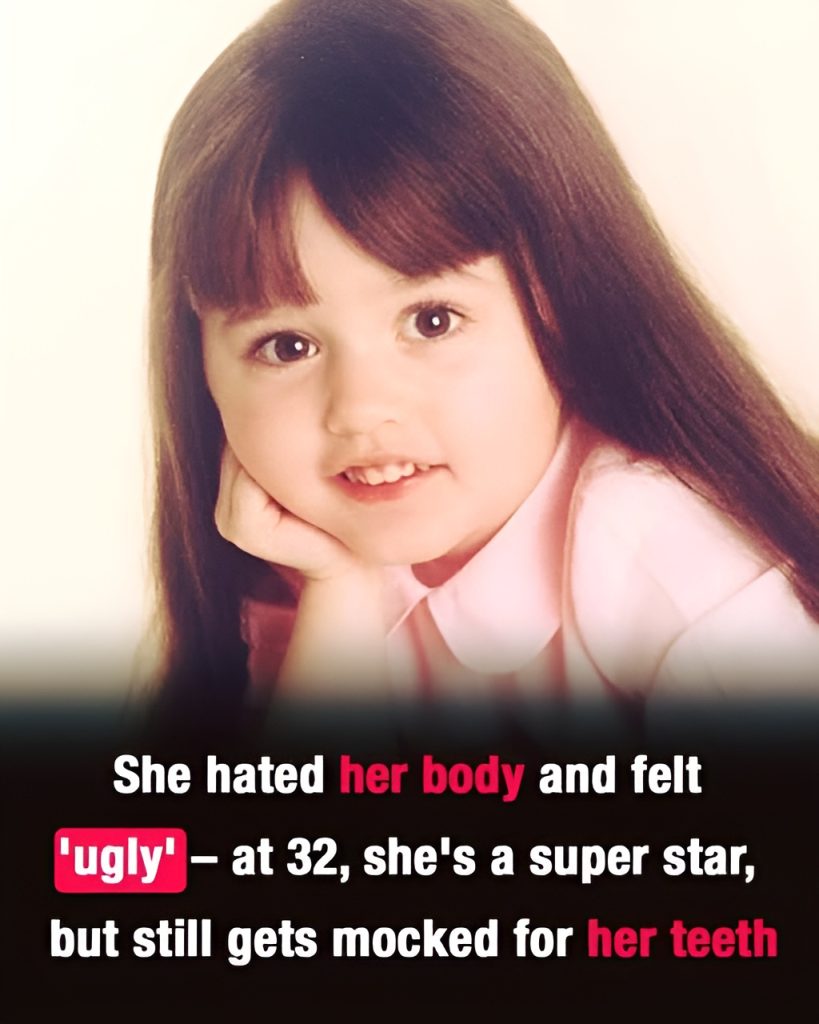 She Once Struggled With Body Image and Felt “Ugly” — Now a Star at 32 Facing Online Mockery For Her Teeth